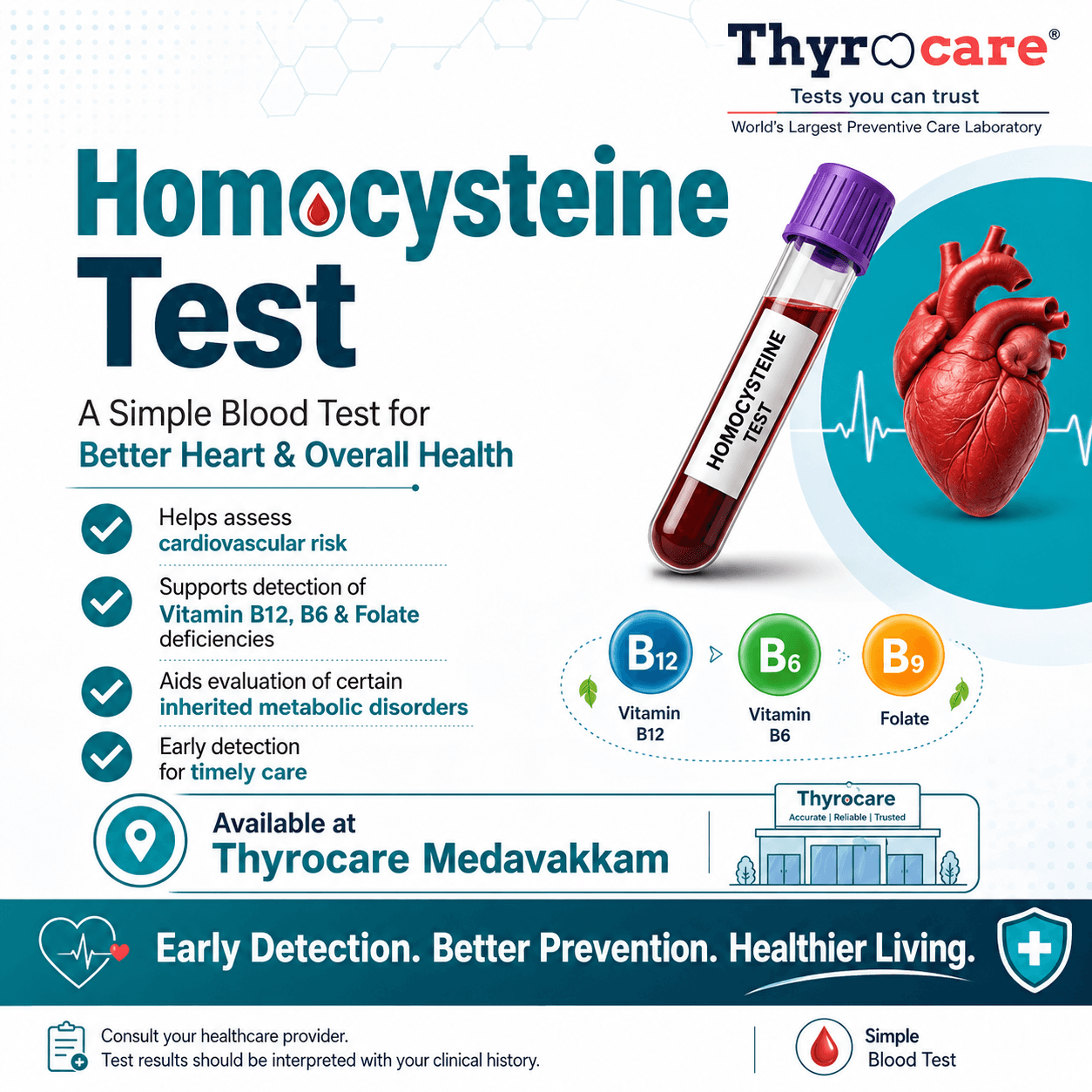 Homocysteine Test