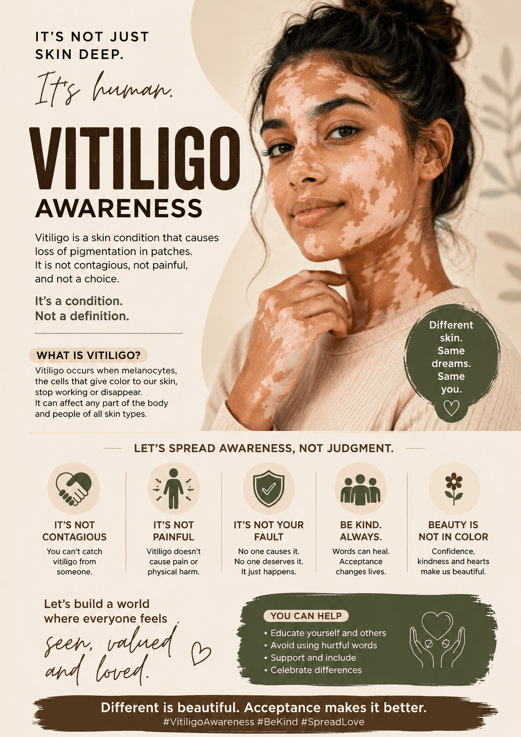 Vitiligo Awareness